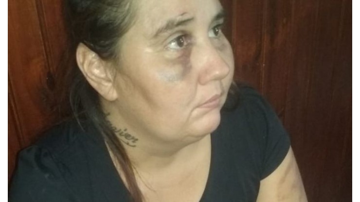 Violencia de género:  mujer fue golpeada por su marido